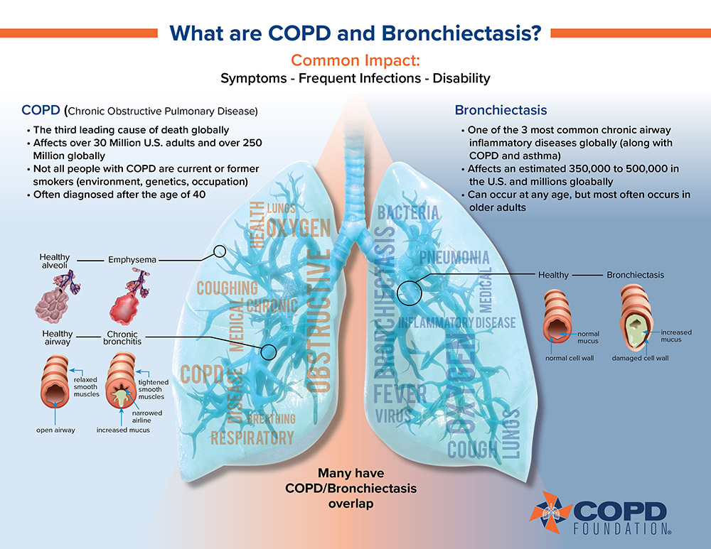 Bronchiectasis COPD Overlap Diagram