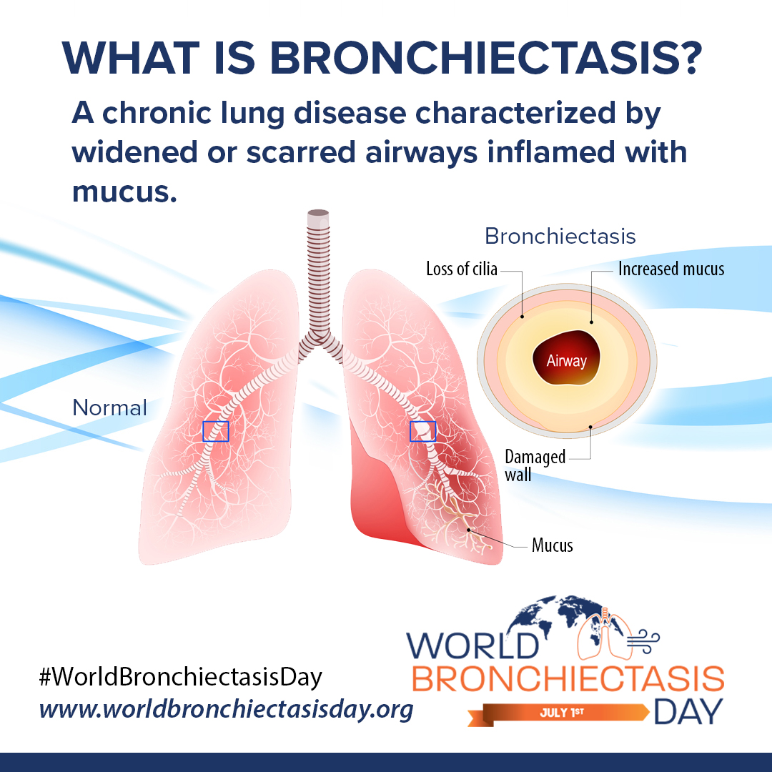 World Bronchiectasis Day Social
